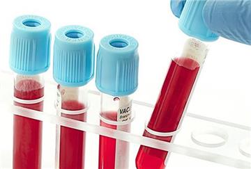 Cấp Giấy phép nhập khẩu mẫu bệnh phẩm trong 15 ngày