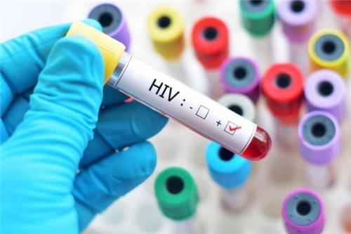 Nơi tư vấn HIV/AIDS phải đảm bảo riêng tư